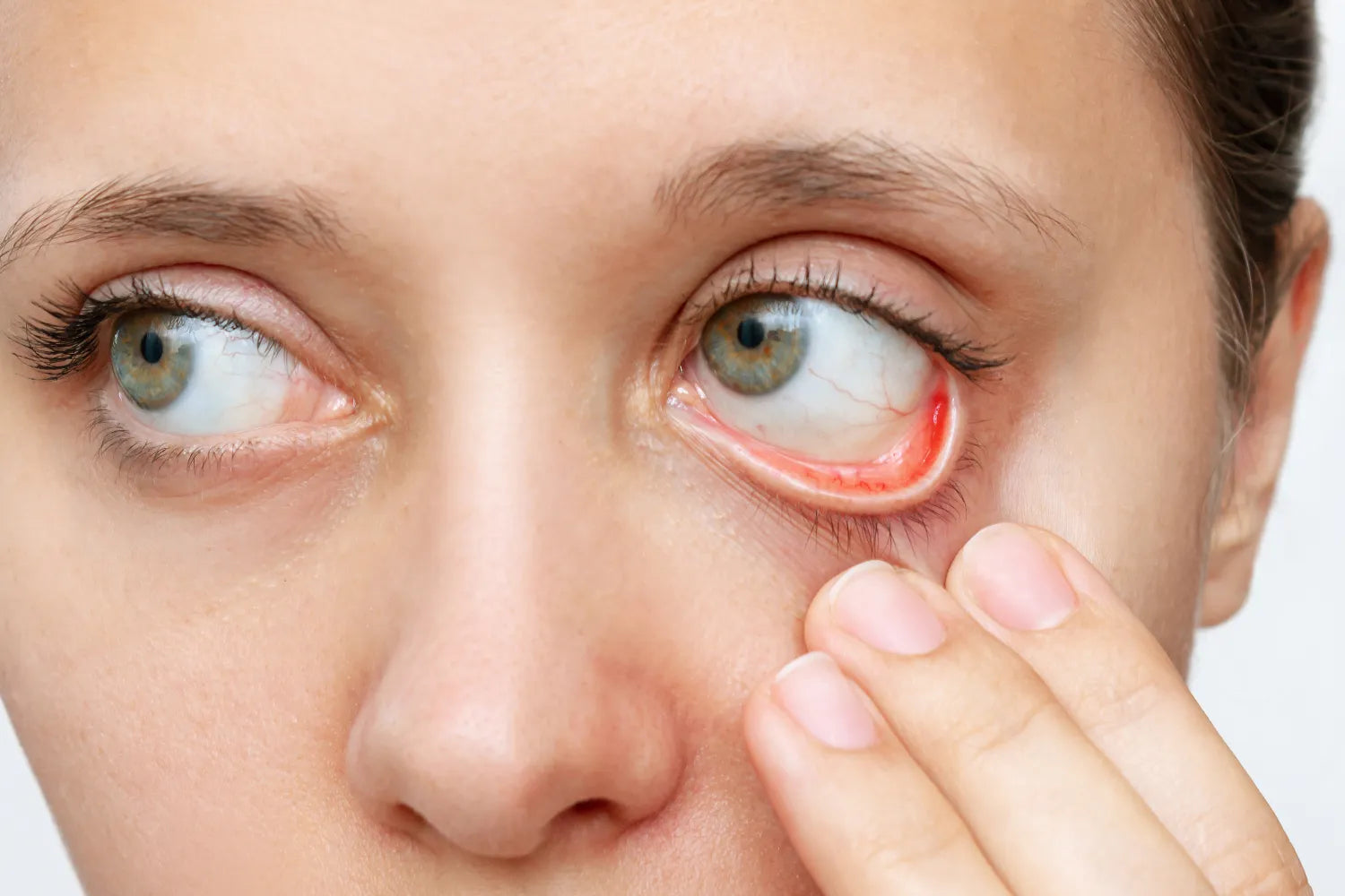 Conjunctiva: Definition, Anatomy, and More