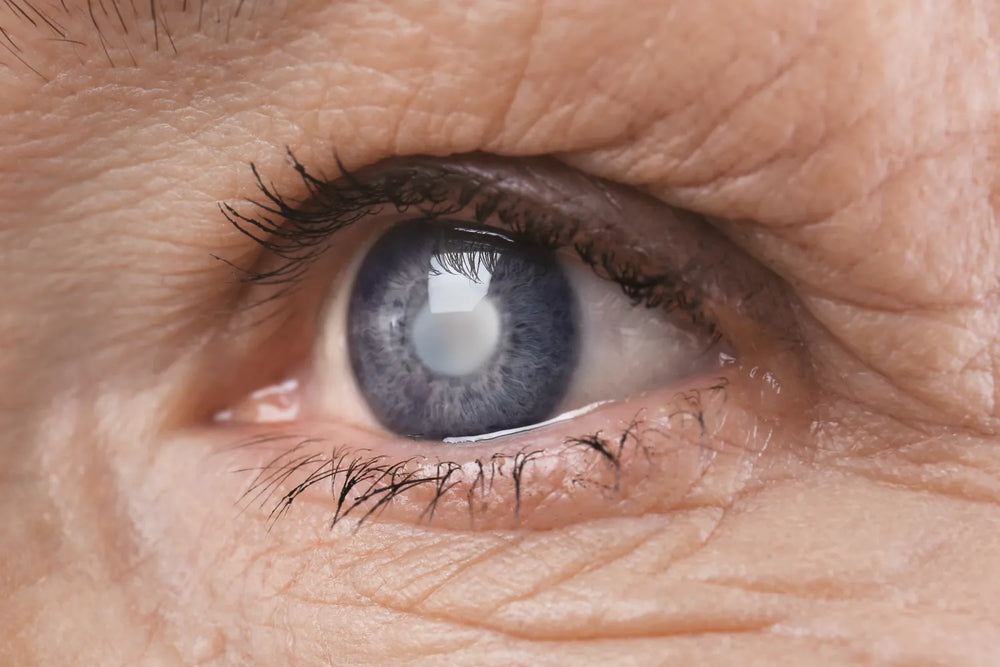 Guide To Understanding the Different Types of Cataracts